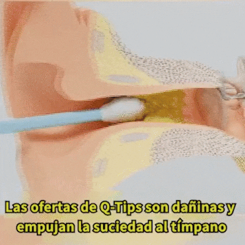 👂🧏♀️Kit limpiador de oídos-¿SIENTES LOS OÍDOS TAPADOS O EMPIEZAS A PERDER AUDICIÓN?